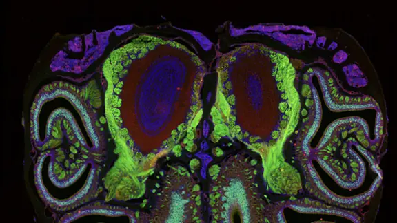 Querschnitt einer Mäuse-Nase mit unterschiedlich eingefärbten Geruchs-Neuronen.