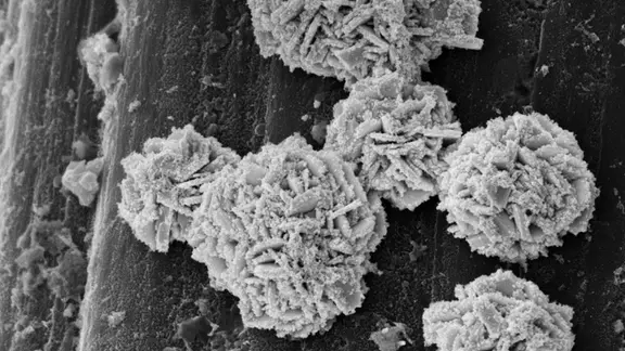 Elektronenmikroskopisches Bild des Katalysators: Die kugeligen Strukturen erinnern an Sandrosen und bestehen aus winzigen Goldplättchen, die mit Platinpartikeln «bestäubt» sind. (Bild: Debasis Maity, Biotechnology and Bioengineering Group / ETH Zürich)