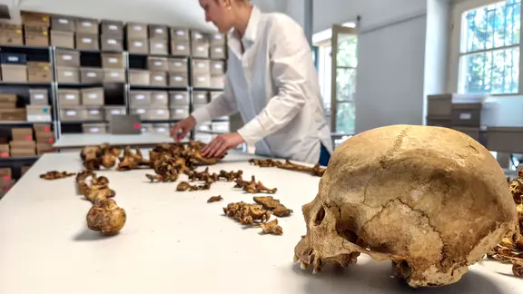 Anthropologische Analyse eines Skeletts von der frühmittelalterlichen Fundstelle Altheim bei Landshut