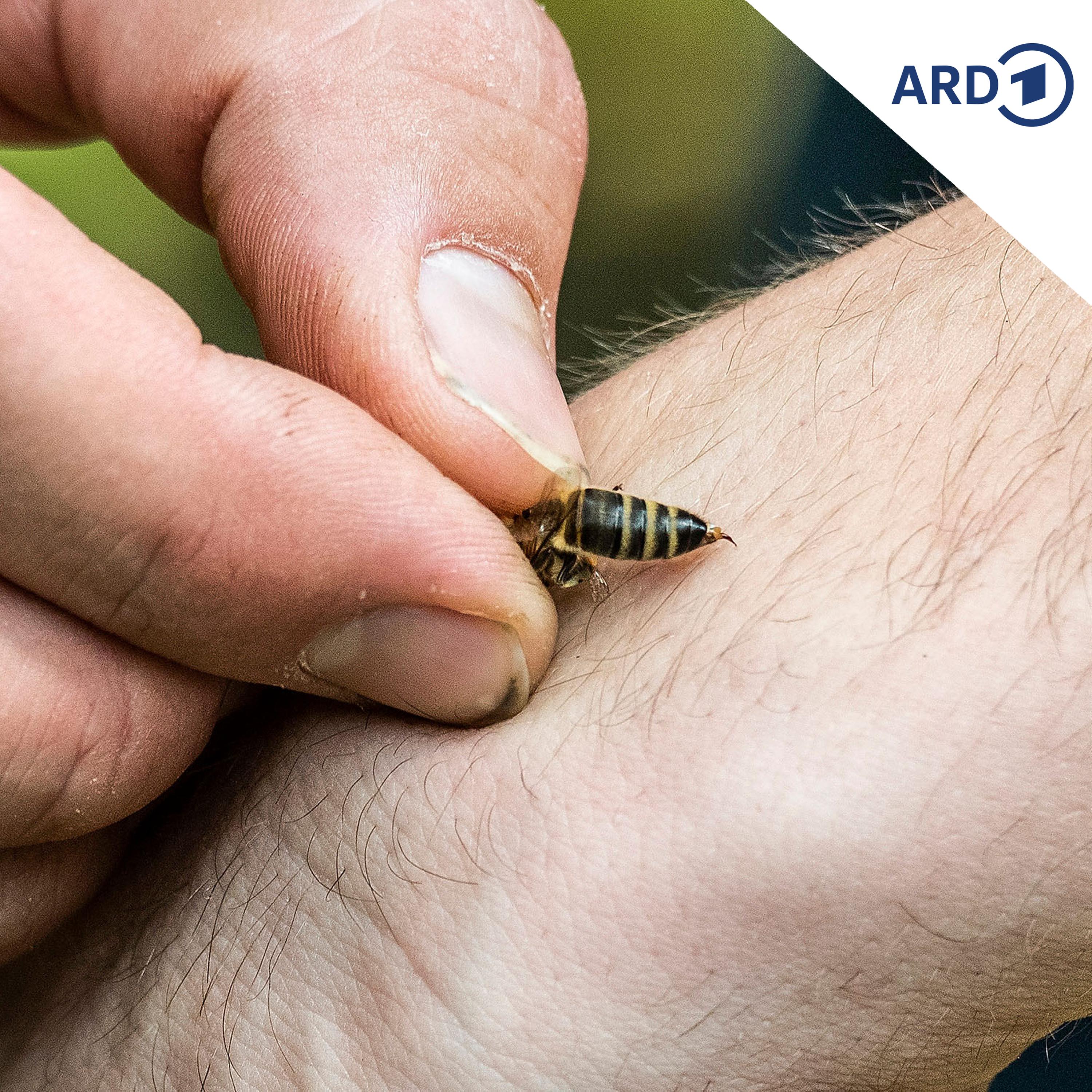 Play Wann wird aus einem Bienenstich ein Dienstunfall?