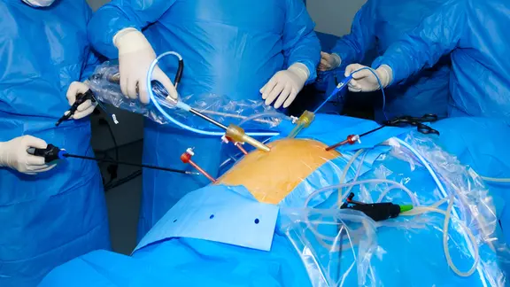 Drei Menschen in blauen Kitteln stehen um einen Patienten und führen Geräte in dessen Bauch.